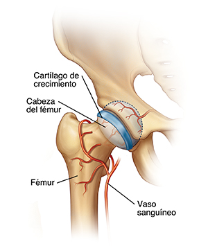 Primer plano de la articulación de la cadera en donde se ve el fémur y su cabeza que se ajustan en la cavidad de la pelvis. Los vasos sanguíneos rodean el fémur y se dirigen hacia la cabeza del fémur. Una placa de crecimiento cruza la cabeza del fémur.